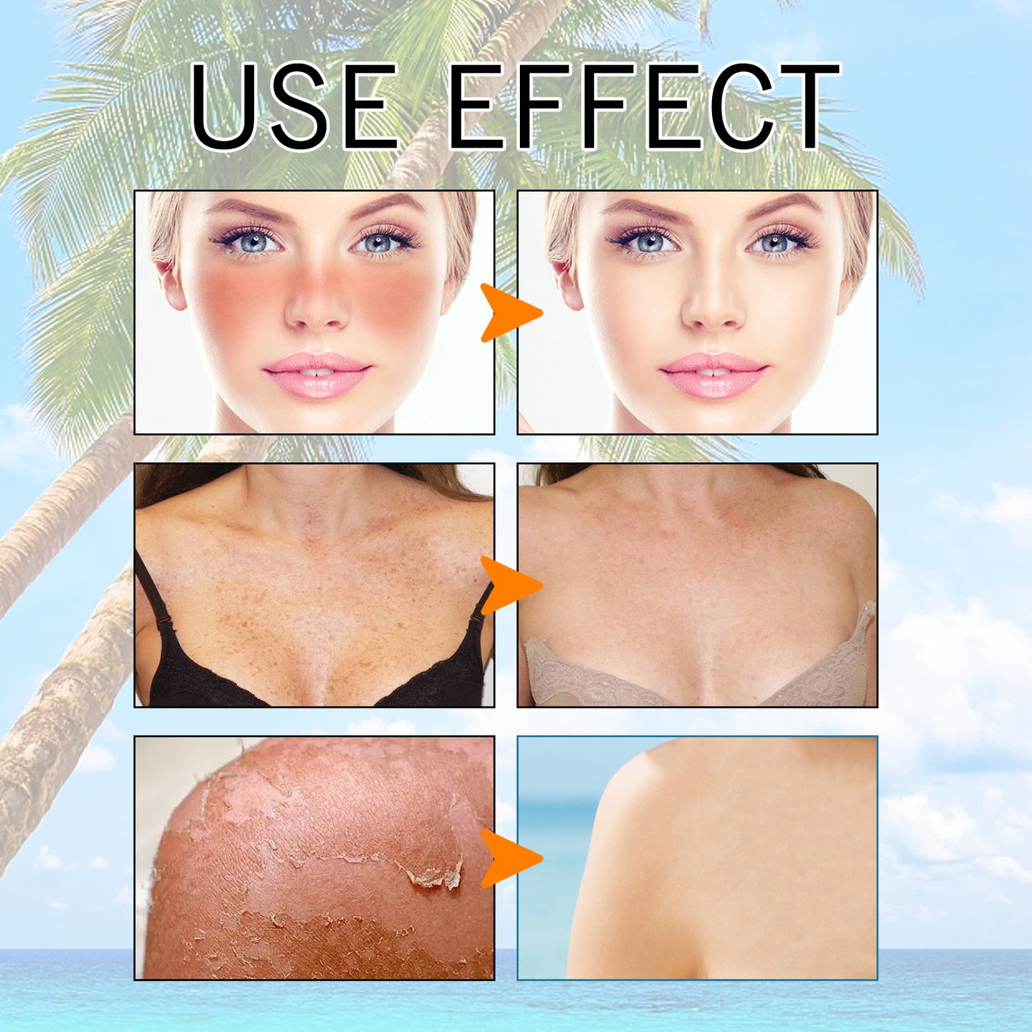 Hyaluronic Acid Sun Gel SPF 50 – Lightweight Moisturizing Protective Gel