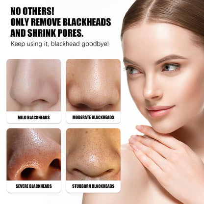 OUHOE Strawberry Peel‑Off Nose Mask – Deep Cleansing & Pore Tightening Blackhead Remover