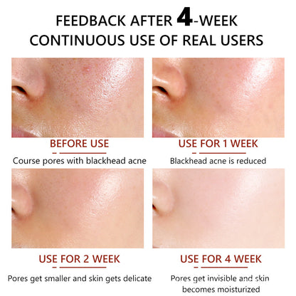 30Ml Cleansing Pore Salicylic Acid