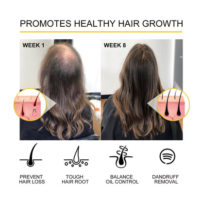 Hair Care Essential Oil Moisturizing And Thick
