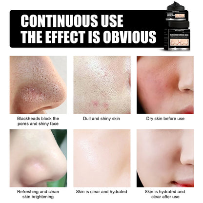 West&Month Blackhead Removal Mask, Peel Off Remove Blackhead Activated Carbon Cleansing Face Mask
